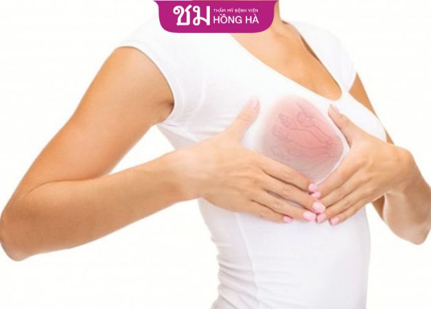 Dấu hiệu cho thấy tắc tia sữa nổi cục