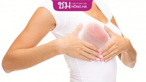 Ngực sau sinh có cục cứng và những điều mẹ bỉm cần biết