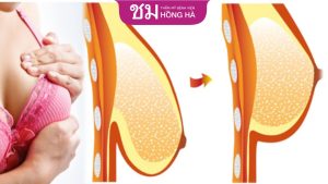 Treo sa trễ được bao lâu? 6 Cách duy trì vòng 1 săn chắc