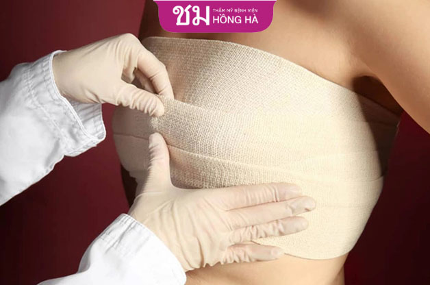 Sau phẫu thuật cần mặc áo định hình trong vòng 1 tháng để định hình ngực