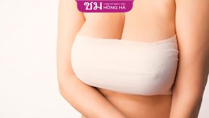 Có nên phẫu thuật ngực phì đại? Những điều cần lưu ý