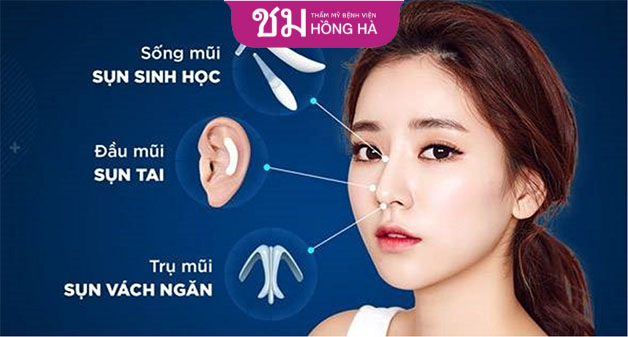 Cần lắng nghe ý kiến bác sĩ để đưa ra lựa chọn chính xác