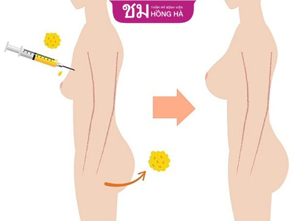 Phương pháo này vừa giúp nâng ngực lại cải thiện vóc dáng hiệu quả