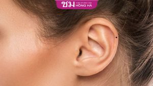ý nghĩa nốt ruồi ở vành tai phải nữ – Giải mã từng vị trí nốt ruồi