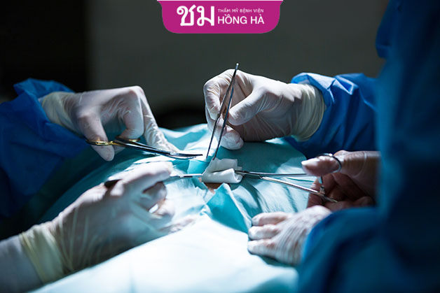 Phẫu thuật bộ phận sinh dục chuyển giới là thủ thuật phức tạp đòi hỏi bác sĩ phải có chuyên môn cao