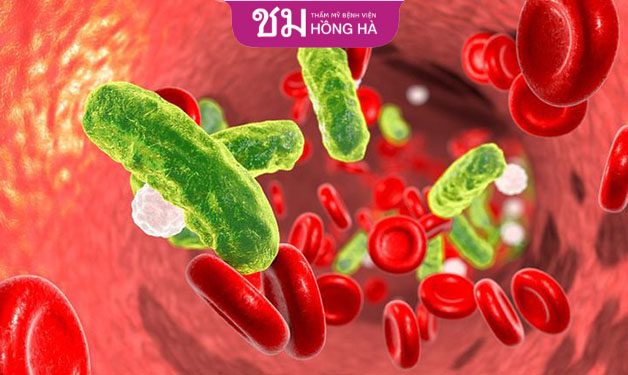 Tình trạng nhiễm trùng máu xảy ra khi phòng phẫu thuật và dụng cụ không đảm bảo
