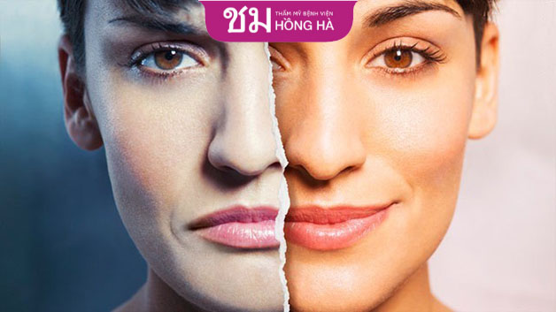 Người chuyển giới chịu áp lực từ nhiều phía nên dễ gặp vấn đề về cảm xúc