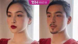 Phẫu thuật chuyển giới nữ thành nam ? Những điều bạn cần biết