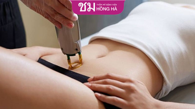 Triệt lông bikini sẽ hạn chế được vi khuẩn gây bệnh và mùi hôi khó chịu