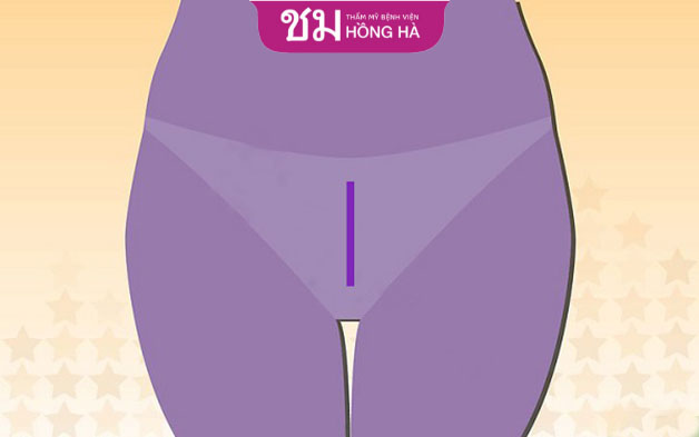 Tạo hình lông kiểu Pháp được nhiều chị em ưa thích