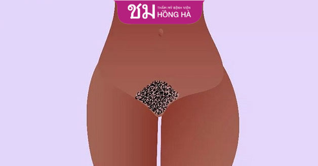 Kiểu tạo hình bụi rậm chỉ cần cắt tỉa đơn giản sao cho gọn gàng