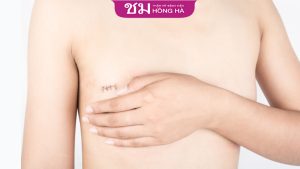 Đánh giá của khách hàng thu nhỏ vòng 1 tại Thẩm mỹ Bệnh viện Hồng Hà