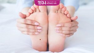 Ý nghĩa nốt ruồi son ở dưới lòng bàn chân? Giải mã vận mệnh của nam và nữ