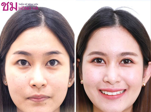 Đôi mắt của khách hàng to tròn, gương mặt thu hút hơn