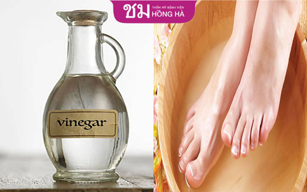Ngâm chân bằng hỗn hợp nước và giấm được nhiều người truyền tai nhau