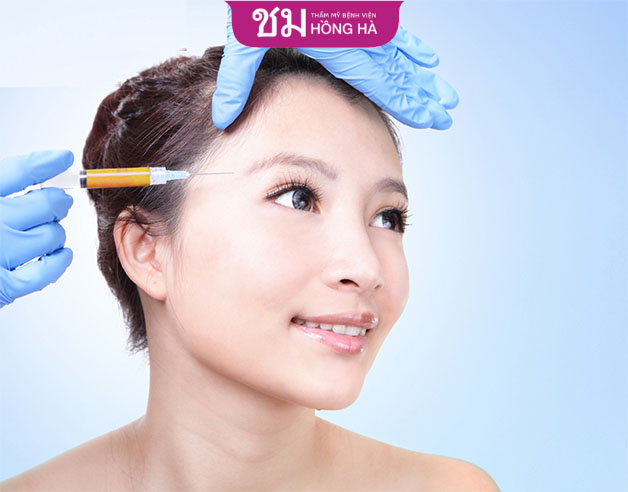 Cấy mỡ vùng mặt sẽ cải thiện các khuyết điểm thái dương lõm, má hóp...