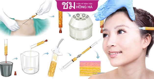Phương pháp này vừa làm đẹp vóc dáng vừa cải thiện khuyết điểm gương mặt