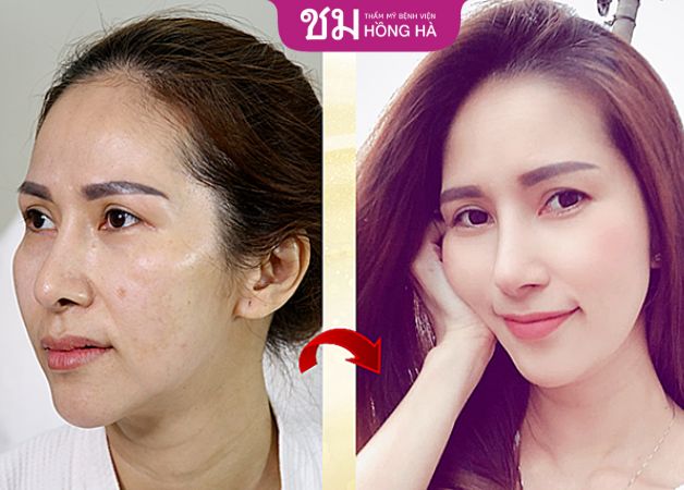 Gương mặt của khách hàng trẻ trung, tươi tắn hơn nhiều