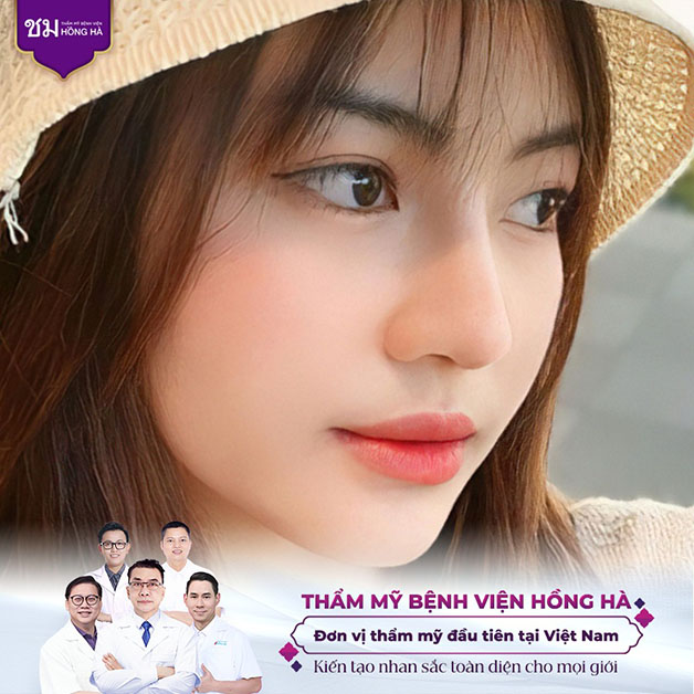 Dáng mũi cao, thẳng không còn lệch vẹo