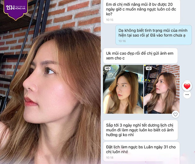Mũi cao thanh tú, hài hòa với gương mặt