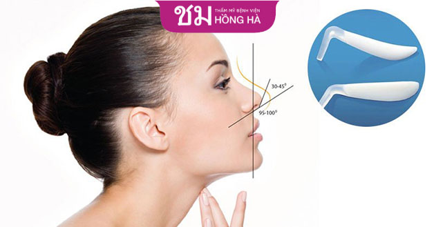 Nâng mũi bằng sụn nhân tạo giúp cải thiện dáng mũi cao hơn