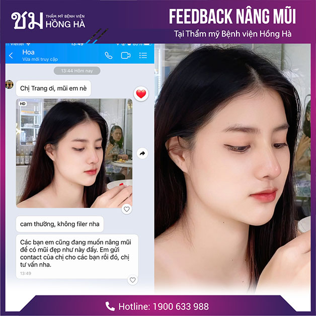 Dáng mũi cao hài hòa với đường nét cùa gương mặt