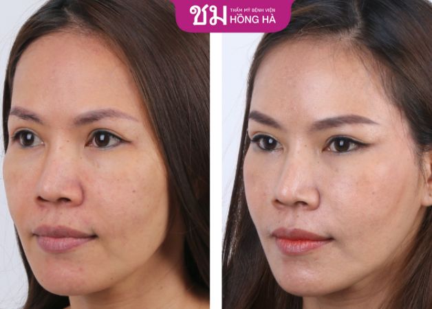 Dễ dàng nhận thấy sự thay đổi trong diện mạo của khách hàng