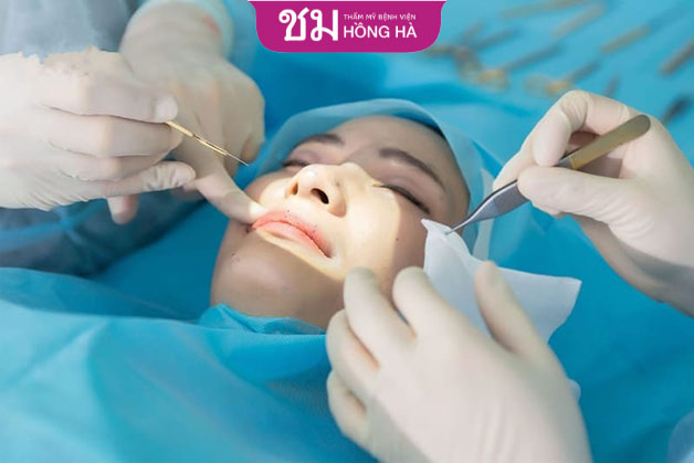 Sau khoảng 60 phút, bạn đã sở hữu dáng môi đúng mong muốn