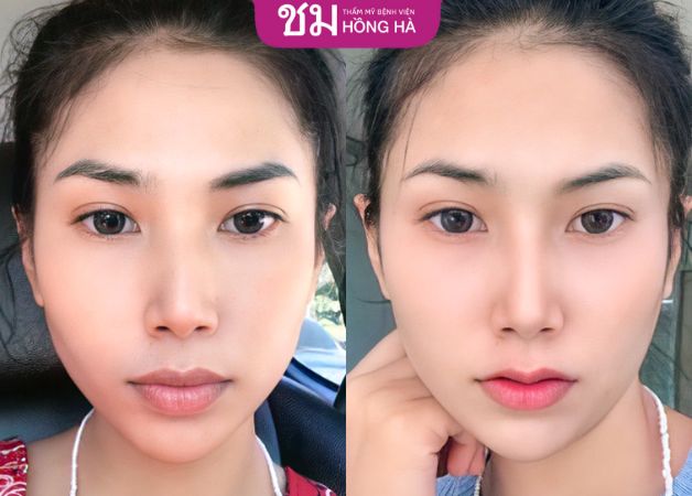 Dáng môi mới tạo điểm thu hút trên gương mặt