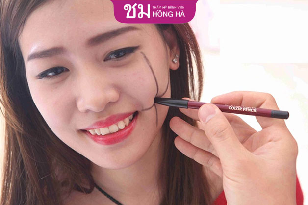 Phẫu thuật tạo má lúm là xu hướng làm đẹp hiện nay