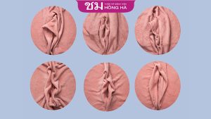 Các hình dạng của cô bé và cách chăm sóc để vùng kín luôn đẹp