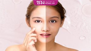 Kinh nghiệm làm trắng da đen bẩm sinh ai cung cần biết