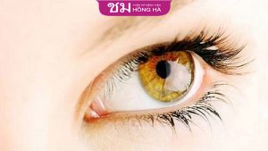 Mắt sói là gì? sở hữu đôi mắt sói nói lên điều gì trong cuộc sống