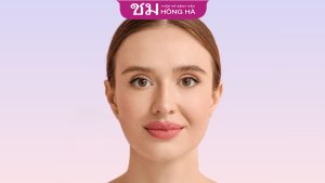 Nam, nữ giới môi dày thì sao? Bí quyết khắc phục tình trạng môi dày