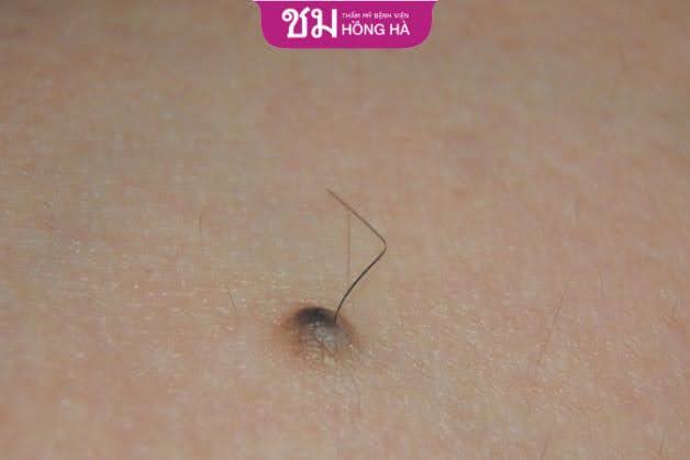 Người xuất hiện nốt ruồi có lông ở ngực thường khiêm nhường, nỗ lực