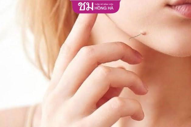Người có lông mọc trên nốt ruồi ở cằm là người thông minh, tài năng