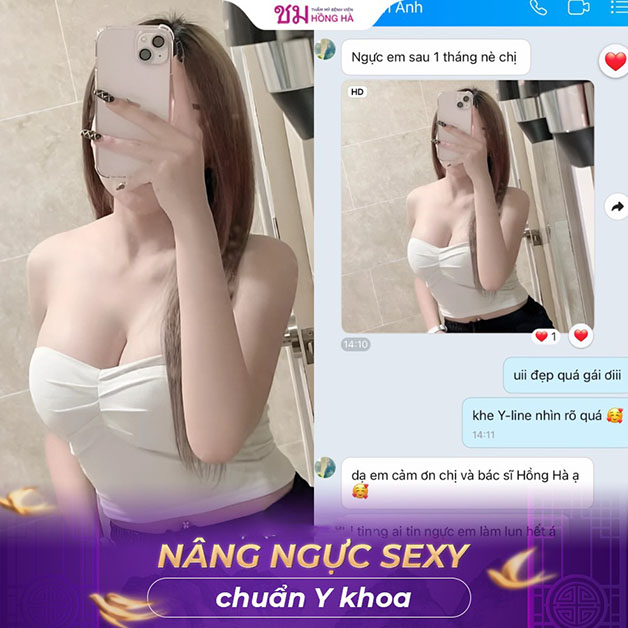 Feedback khách hàng sau 1 tháng được bác sĩ Cường thực hiện nâng ngực