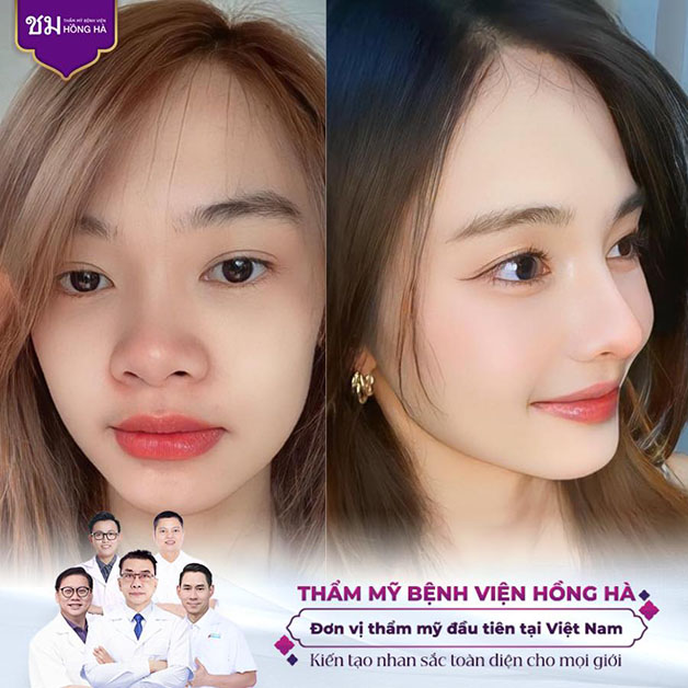 Dưới đôi bàn tay khéo léo của bác sĩ Cường, khách hàng sở hữu diện mạo thu hút hơn nhiều