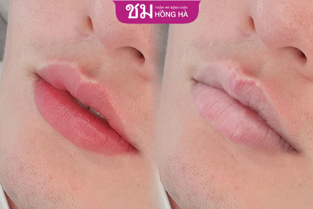 Phun môi không chỉ mang đến màu sắc tươi tắn mà còn giúp môi căng mọng hơn