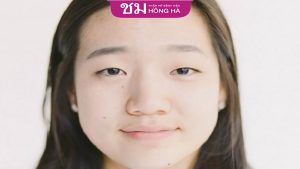 Mũi sư tử thể hiện điều gì về vận số? Sửa mũi ở đâu an toàn?