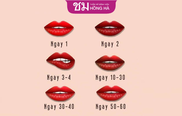 Môi sau khi phun sẽ thay đổi theo từng ngày