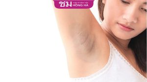 Tại sao nách bị thâm? Cách trị thâm nách hữu dụng