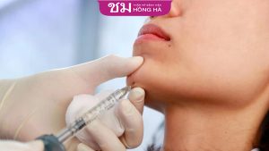 Tiêm filler cằm là gì? Những ai nên tiêm filler cằm