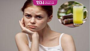 Uống nước mía có nổi mụn không?  Lưu ý khi sử dụng